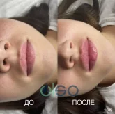 Клиника эстетической косметологии лица и тела OLSO фото 22